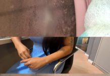 Jovem denuncia que ficou dois anos com gaze no abdômen após cesárea no Hospital Regional de Guarabira: “deformou minha barriga”